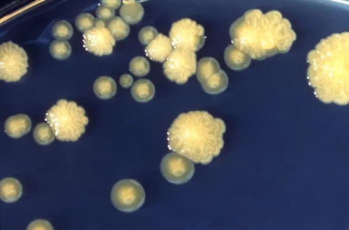 Enterobacter cloacae: Częste objawy i leczenie infekcji